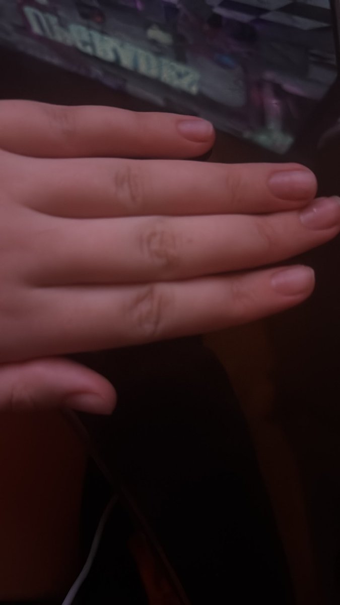 samsleftflipper's tweet photo. Finally got these bum ass nails off istg the pmo so bad 😭 https://t.co/cuPu4iKcMA