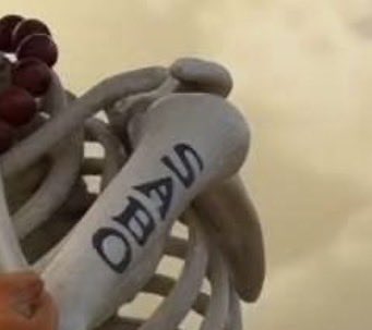 m4d0kk4's tweet photo. why tf does he have sabo written on his bone wtf https://t.co/A5Vmn7oY8g