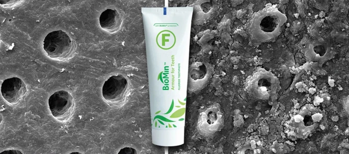 lauriewired's tweet photo. actually, the best toothpaste comes from US Army research into bioactive glass for bone repair during the vietnam war.

a professor in london expanded upon the research for bone grafts and rolled the tech into a company called biomin.  fills the dental microtubules with bioglass that has insane acid resistance

very difficult to get in the US though, it's not OTC.  it's pretty amazing though