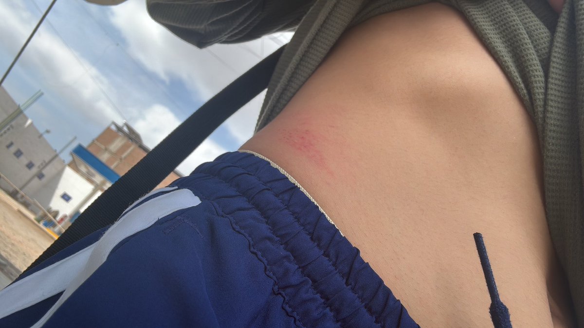 george240795's tweet photo. Ouch https://t.co/LcduRCzdkI