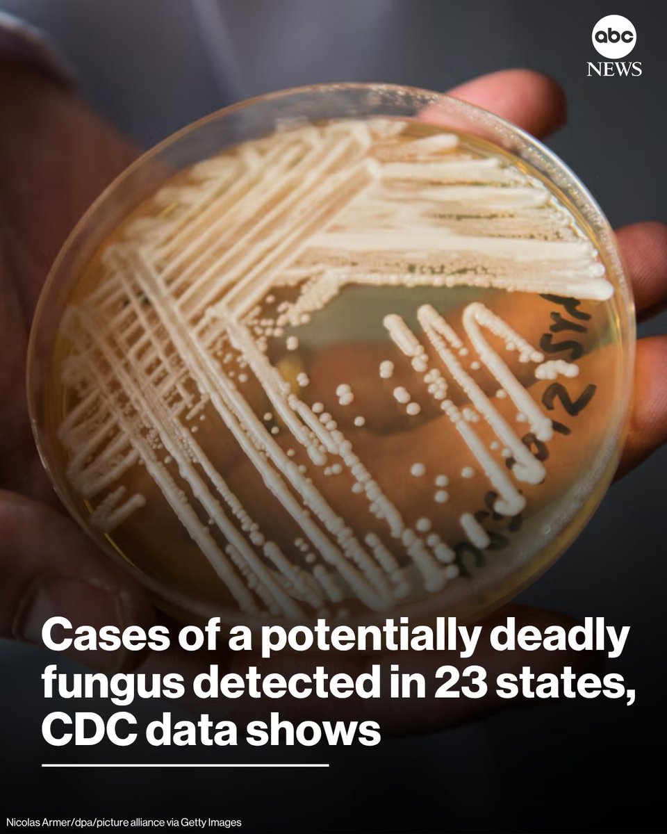 ABC's tweet photo. Cases of a potentially deadly fungus have been detected in 23 states so far this year, according to data from the CDC.
 
As of July 18, there have been 3,130 cases of Candida auris (C. auris) identified. https://t.co/dJcpbWJBNU https://t.co/Dj1tHgx6uQ