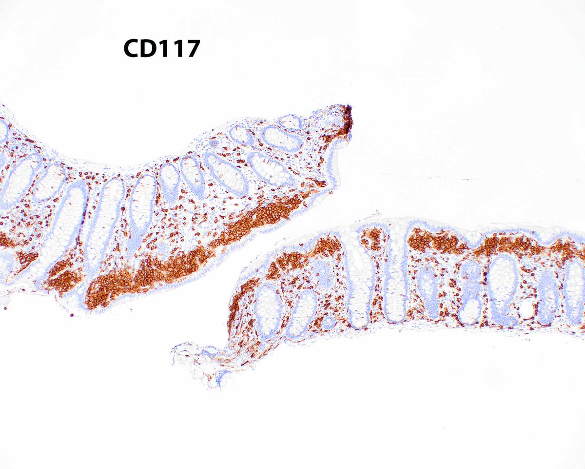 ModernPathology tweet picture