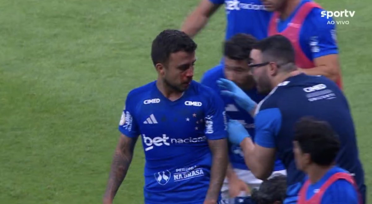 futebol_info's tweet photo. Matheus Henrique deu o sangue pelo gol do Cruzeiro.

📸 Reprodução/Sportv https://t.co/YvrngQUjaM