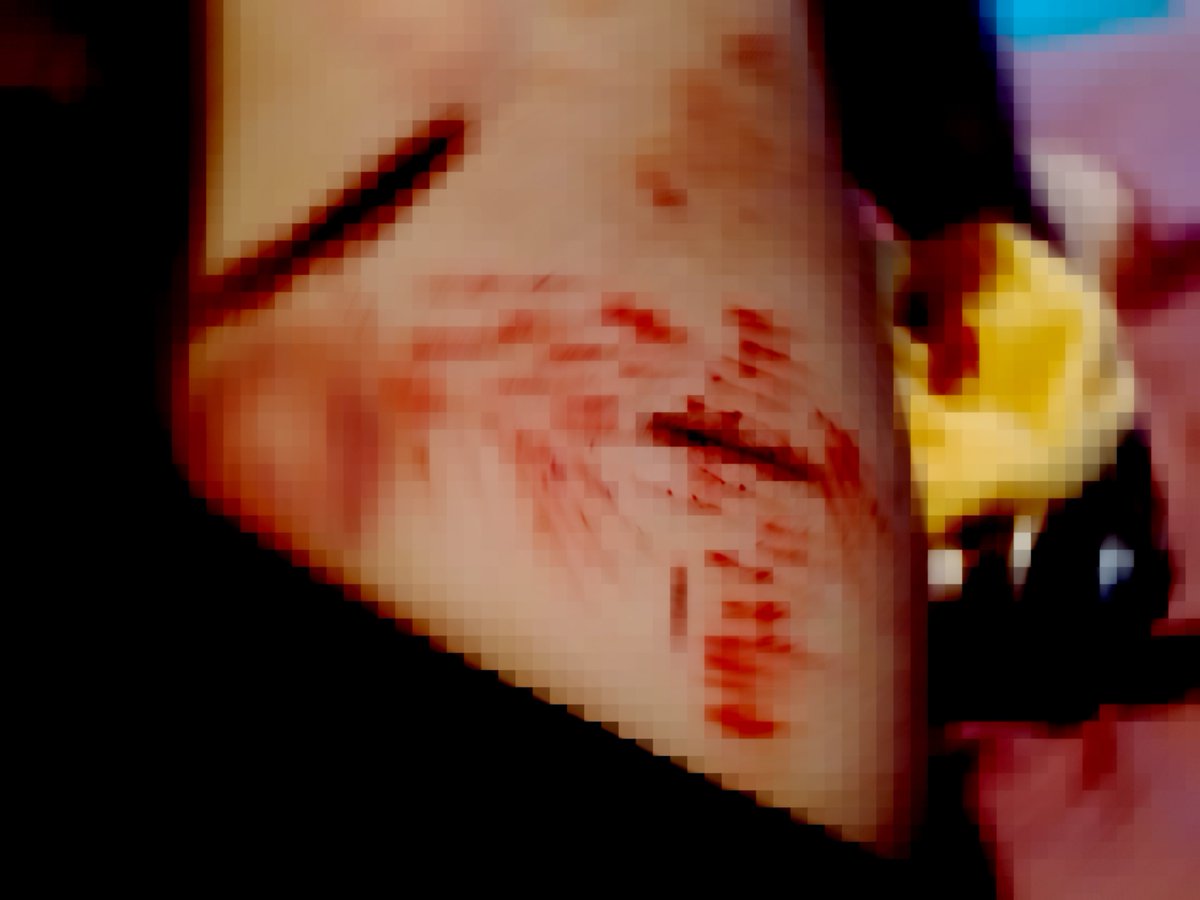 daannii364's tweet photo. #makeupfake
#shtw #babycuts
Don't know https://t.co/mapR2oIB6o