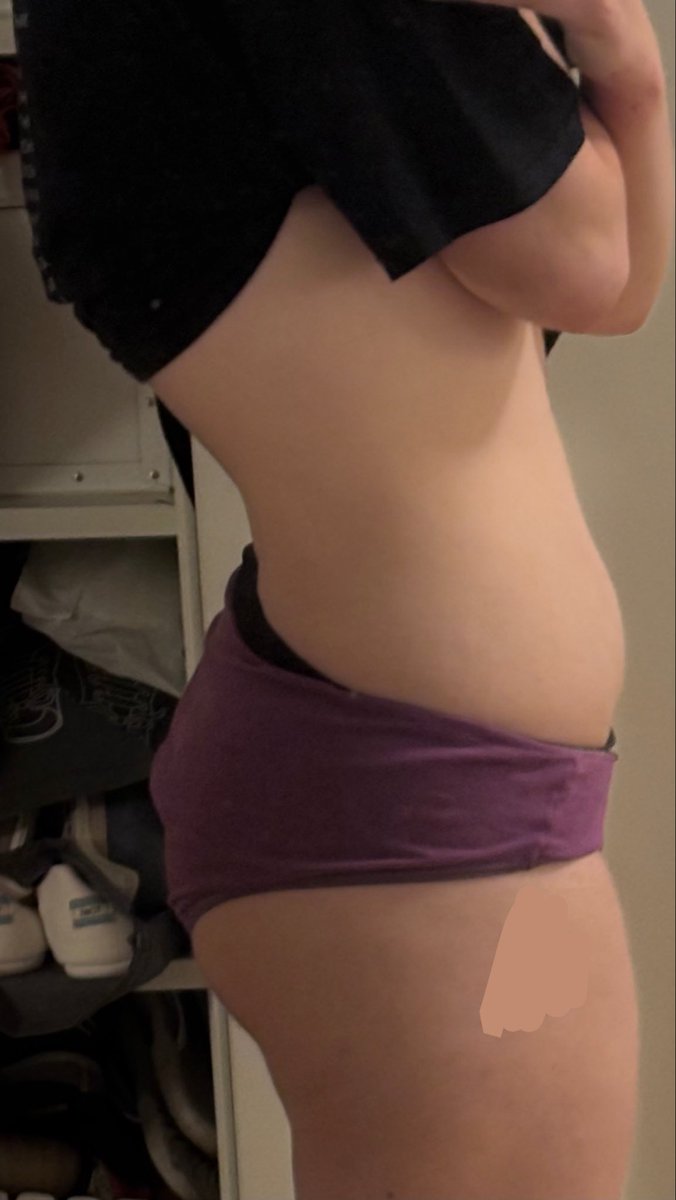 ednosblades's tweet photo. 189lbs (sw) જ⁀➴ 149lbs (cw) 

…before and after to make myself feel a little better about how this disorder has anally fisted my life 
#edrtwt #wl #wltwt #anatwt #ednos #shtwt https://t.co/k3BwEnmzf2