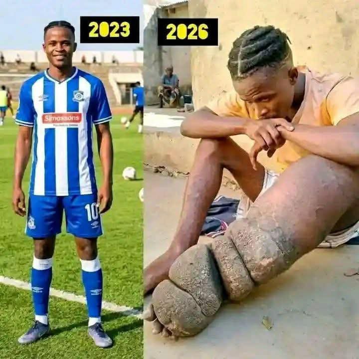 Kene_Nnewi's tweet photo. This story will break your heart.💔

Oluwatimi is a young boy from Ibadan.  He loved football from secondary school.  
He was very talented, especially with his left foot.  

Shooting Stars Academy saw his skill and invited him.  
He joined them and trained hard every day.  He was dedicated and full of hope.  

Just when they were ready to promote him to the senior team with real pay and all the benefits of a professional player disaster struck.  

A stroke attacked his left leg.  
The same leg that once ran and scored goals.  

For more than two years now, he cannot walk.  

His football career stopped.  
His dreams are on hold.  

This is the sad story of Oluwatimi.