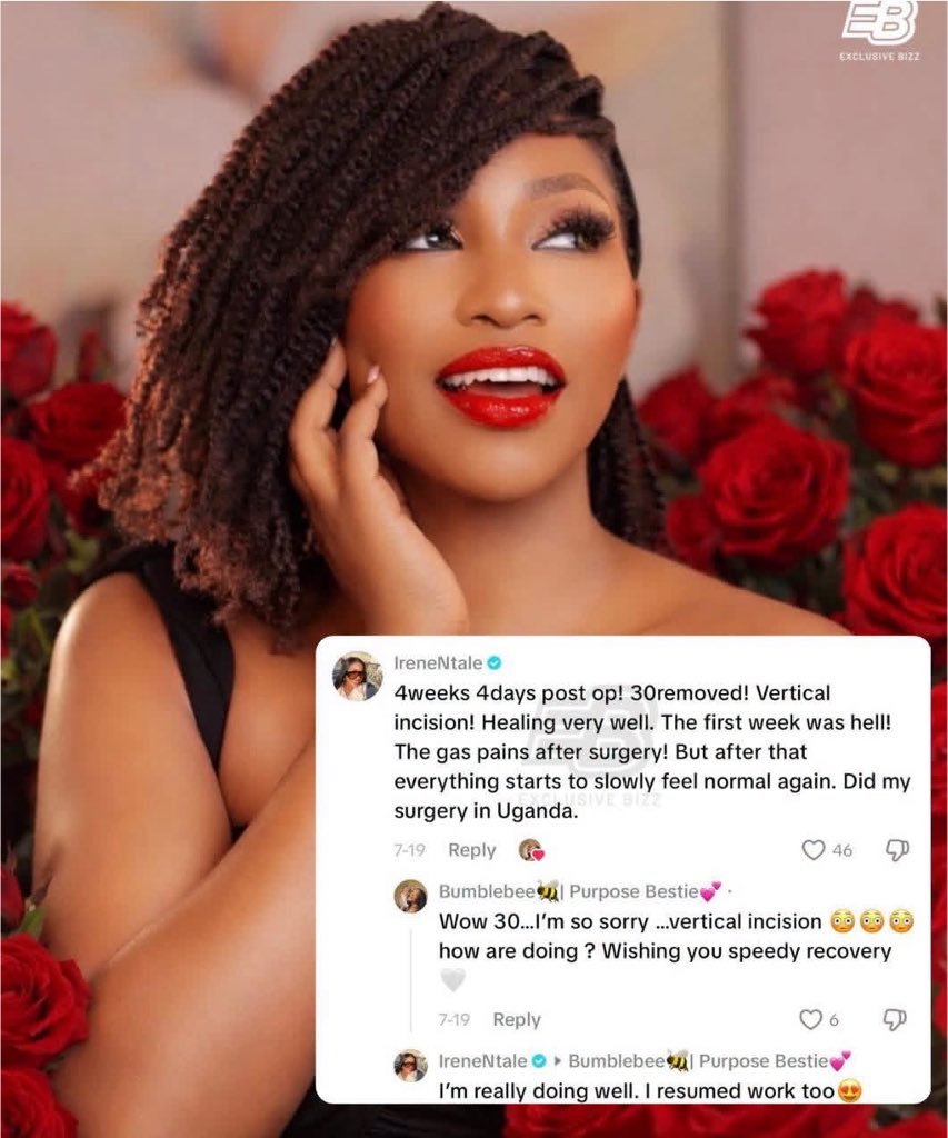 MarionsEsther's tweet photo. Songbird Irene Ntale has opened up about her health, revealing that she recently underwent successful surgery to remove 30 fibroids. She is now on the road to recovery.😩 https://t.co/syvqjv2Yk2