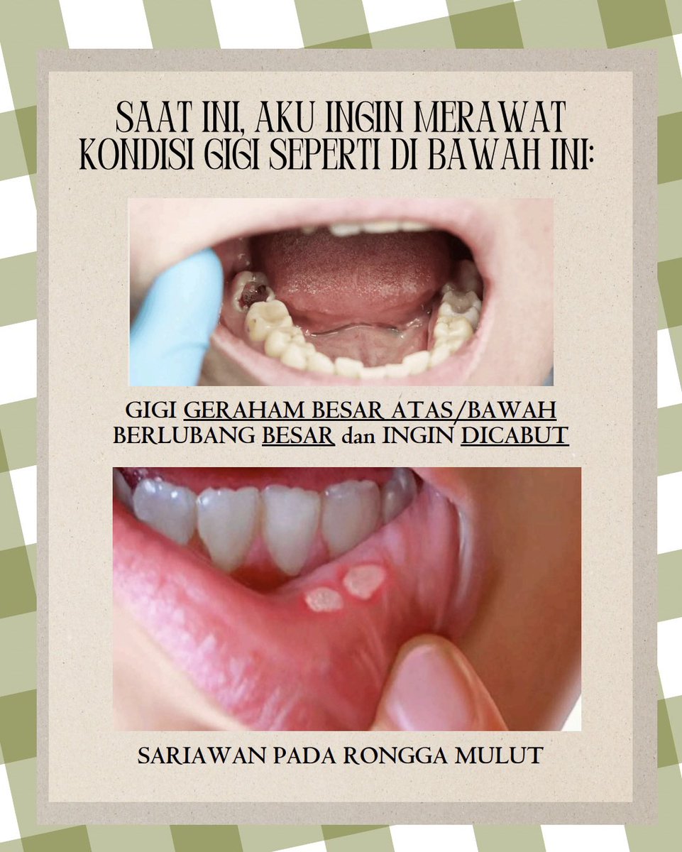 toufflemire's tweet photo. [RTs are appreciated 🥹🙇🏻‍♀️] 

Hallo! Aku Nana, koas gigi Jogja. 🦷🪥

Kalau kamu dom Jogja, punya keluhan gigi GERAHAM BERLUBANG BESAR dan ingin DICABUT oleh koas secara GRATIS, boleh reply/ketuk DMku yaaa! :D 

Kalau mau konsultasi juga boleeehh 😁👍🏻 https://t.co/EUNJ0xUzxP