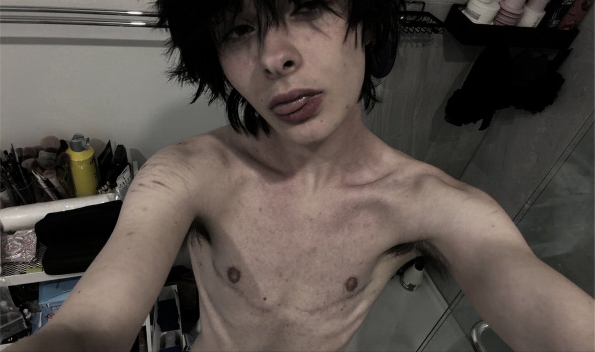 onyxsjournal's tweet photo. //bodycheck (87.3 lbs) 
so fat you cant see my chest bones unless i pose </3
#edrtwt #shedrtwt https://t.co/UX7vrAG9p1