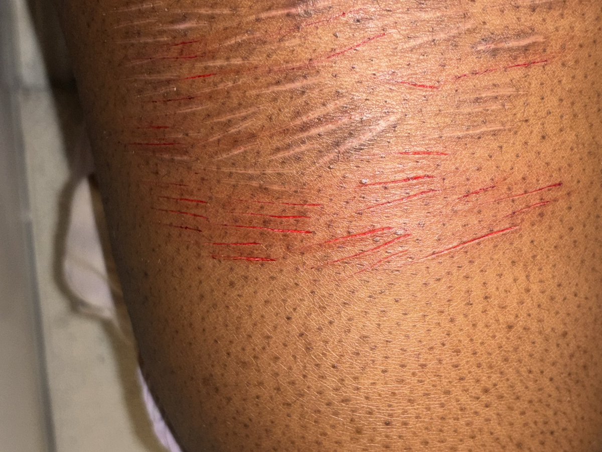 Larpland4rtk's tweet photo. I did a little SFX THAT IS NOT REAL AT ALL AND IS FOR HALLOWEEN but I couldn’t do a lot cuz my sisters are home (don’t mind how big my thighs are im tryna fix that) #notreal #sfx #makeup #blockdontreport #slitttwt #shedtwt #styrotwt #gay #twink #fatspo https://t.co/tPWcIY3bJd