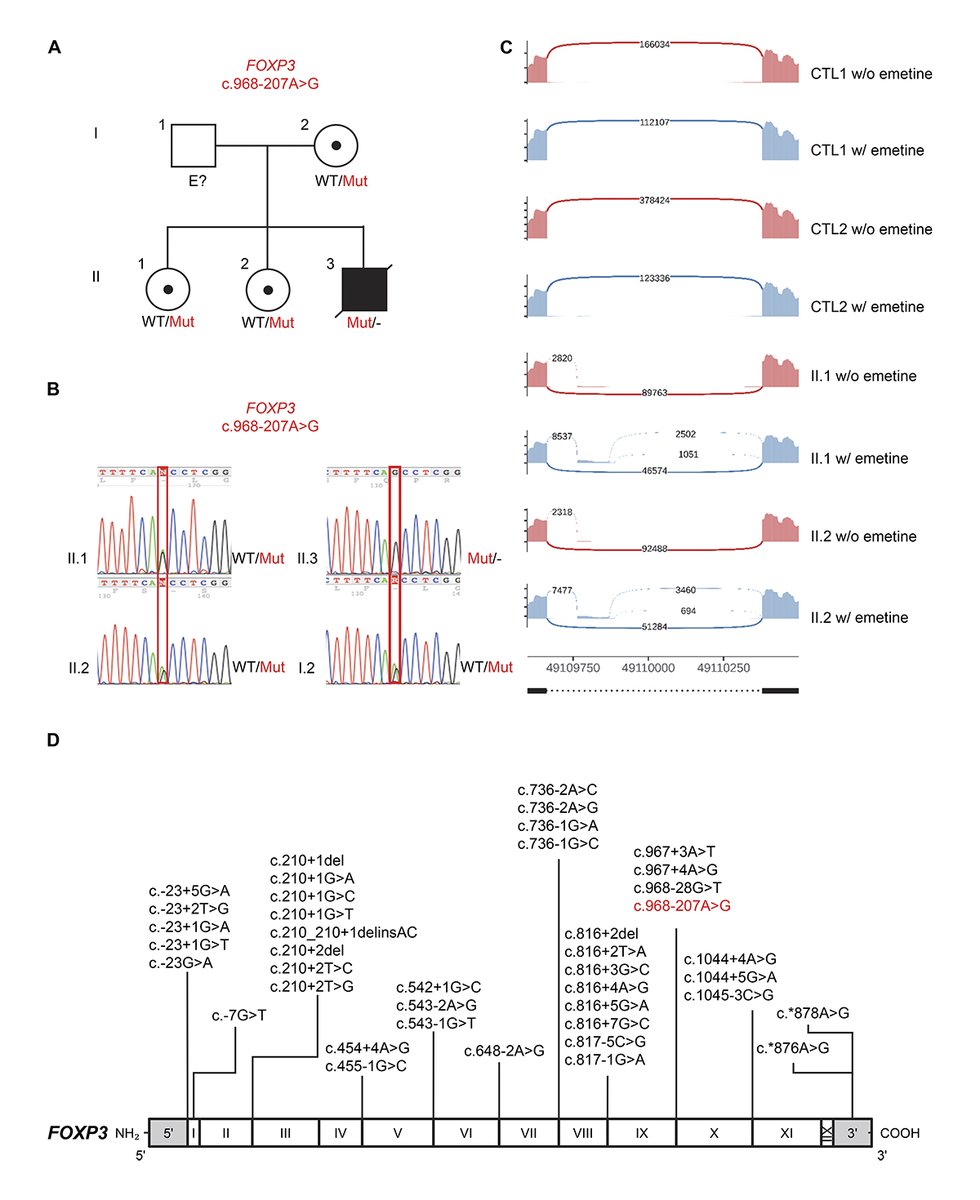 jhumimmunity's tweet photo. Gaufryau, Stolzenberg, @JRosain et al. report a deep intronic #FOXP3 pathogenic variant that was investigated by RNA sequencing in heterozygous female carriers. https://t.co/TJ4P7g4hgl 

#Atopy #Diagnostics #Autoimmunity #InbornErrorsOfImmunity #IPEX https://t.co/9i8YGUvyDG
