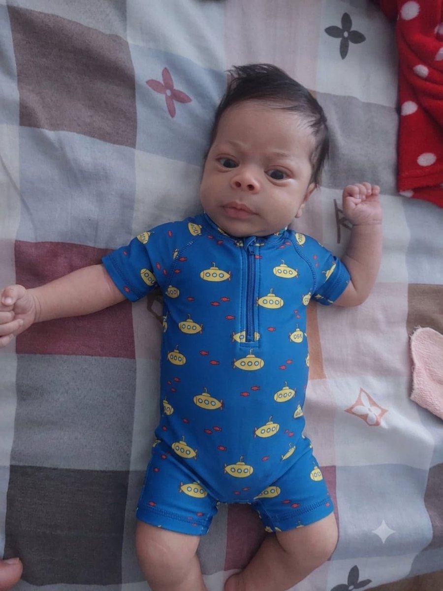 AminPerso's tweet photo. Içhak Tbahriti n'a que 2 mois. Le jour de sa naissance, ses parents ont découvert une malformation non détectée pendant la grossesse.
En tant que père, je n'ose imaginer la douleur de découvrir ça le jour même de la naissance de son fils.
Mon cousin en Algérie a besoin de nous. https://t.co/7got1cHSdo