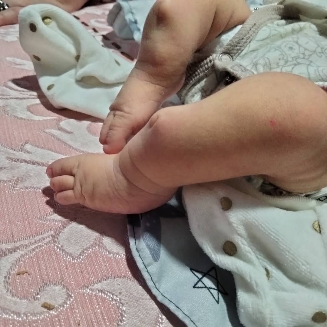 AminPerso's tweet photo. Içhak Tbahriti n'a que 2 mois. Le jour de sa naissance, ses parents ont découvert une malformation non détectée pendant la grossesse.
En tant que père, je n'ose imaginer la douleur de découvrir ça le jour même de la naissance de son fils.
Mon cousin en Algérie a besoin de nous. https://t.co/7got1cHSdo