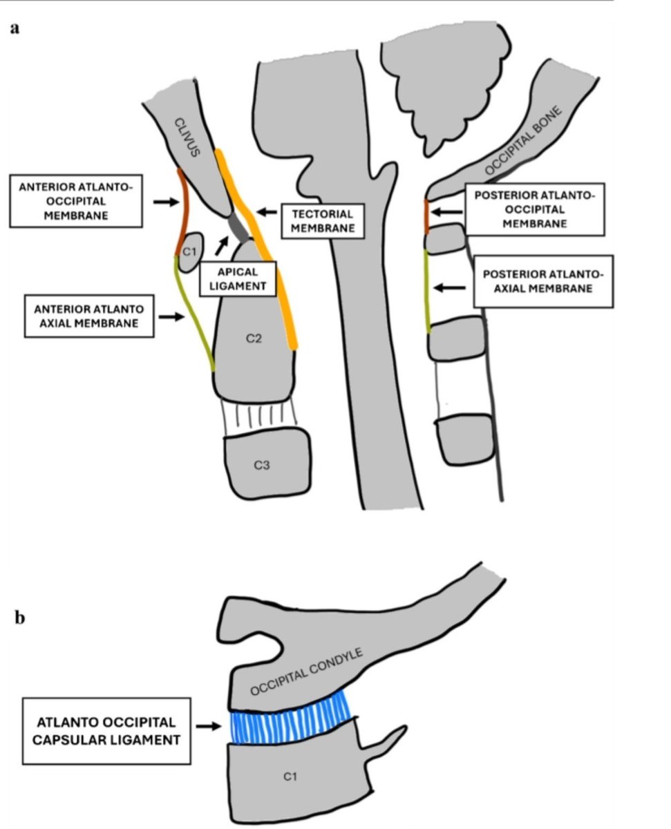 spinacademics's tweet photo. SPIN Tweetorial Wednesday 🧵

Today, we journey to the craniocervical junction—where the skull, atlas and axis form a remarkably mobile yet highly vulnerable osteoligamentous unit.

Let’s meet the ligaments that keep the skull attached to the spine. https://t.co/DsSzIwzTBk