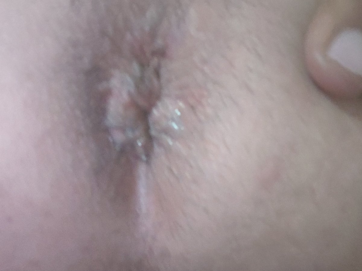 SerkanO14862453's tweet photo. Sikildikden sonraki hali https://t.co/KdT1NZHkKV