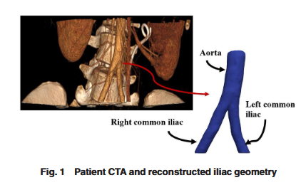 ASMEJournals's tweet photo. Uncertainty analysis for blood flow simulation with image segmentation and numerical inputs. https://t.co/Wsrhn0n127
#Hemodynamics #uncertainty https://t.co/u7gECj52bR
