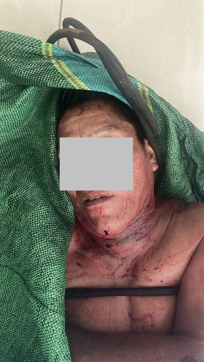 Frospigliosi's tweet photo. Hoy el Comando Especial VRAEM eliminó a un dirigente narcoterrorista, “Richard”. Un efectivo militar resultó herido (derecha) en el enfrentamiento. Así hay que acabar con con esos criminales! https://t.co/XBlyofRoWE