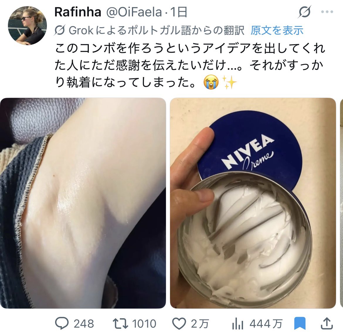 _______h9q's tweet photo. @World50bY 私も同じコンプレックスで…Xで見つけた海外のお姉さんの「ニベアとThe Ordinaryのエクスフォリエイティングトナー」を試そうとThe Ordinary の到着を待っているところです https://t.co/lyy8bDNPko