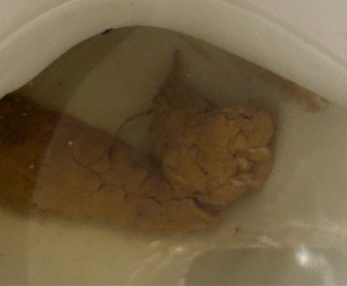 petervsseth's tweet photo. Odd poo poo https://t.co/ybEhvgwCbO