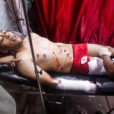 ali__hamdouna's tweet photo. People wounded today alone as a result of Zionist shelling. https://t.co/BponEU8dO6