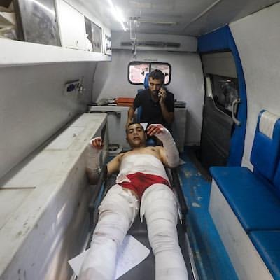 ali__hamdouna's tweet photo. People wounded today alone as a result of Zionist shelling. https://t.co/BponEU8dO6