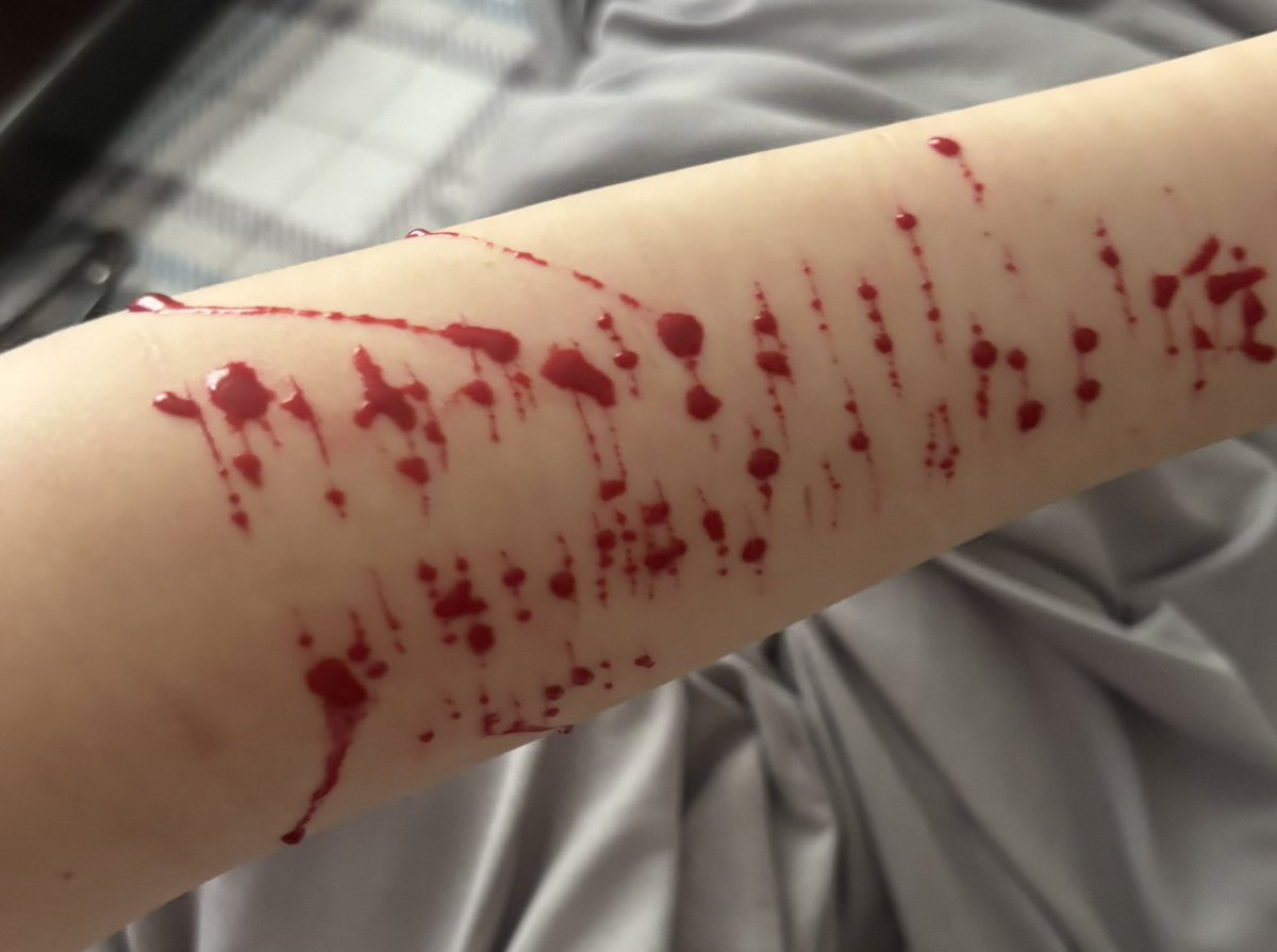 bluddy_bunny's tweet photo. Dramatic cat scratches 😭✌️ FAKE BLOOD FAKE BODY AI MAKEUP SFX 👀👀👀 #shtwt #shedtwt #slittwt #selfharm #sh https://t.co/JRHvsDWABl
