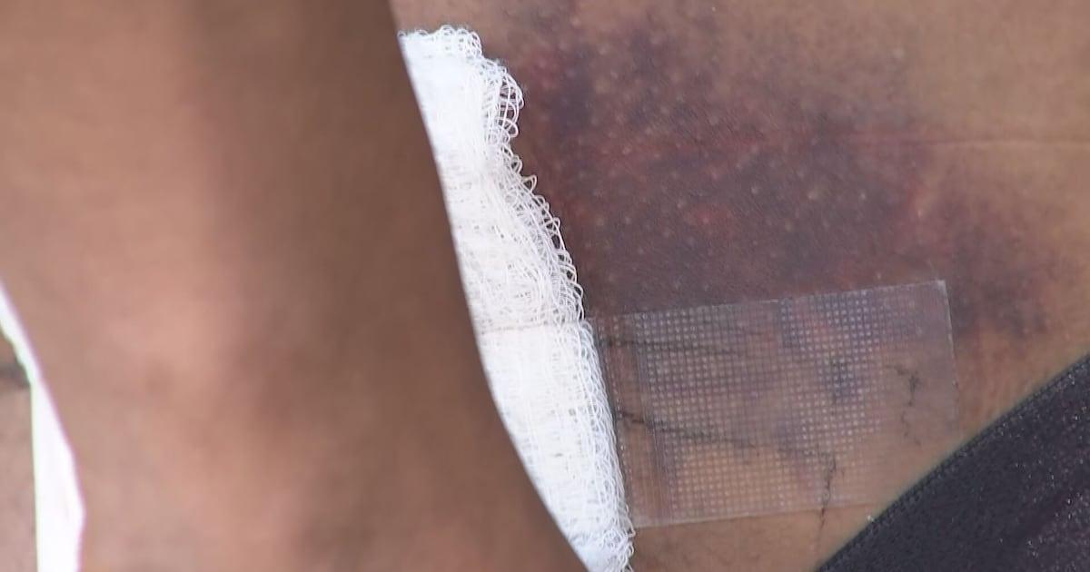 KIRO7Seattle's tweet photo. ‘I saw everything happen’: Bite of Seattle shooting survivor still has bullet lodged in body https://t.co/5dSkdIvj46 https://t.co/lPjtumHWKm