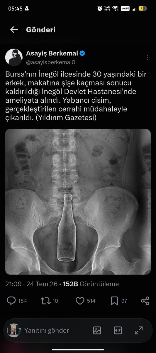 Bahozksya's tweet photo. @sikici16brs @andresipekovicc önce şişeyi bi g’tünden çıkar https://t.co/ggrEfuy3k6