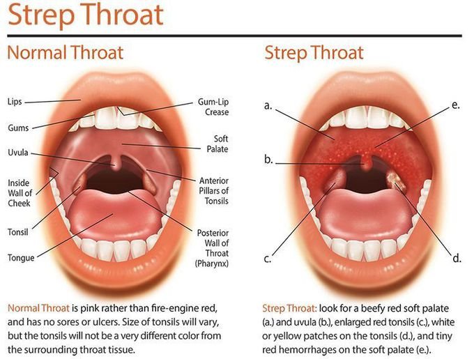 XainzaP's tweet photo. ✅ Two traditional medicine home remedies to fight tonsillitis/strep throat and pus spots on the throat:

🟡 warm water and salt gargle

🟡 honey and lemon gargle

(3 or 4 times a day)

It helps reduce inflammation and expel pus naturally! https://t.co/fgQjd02XJ1