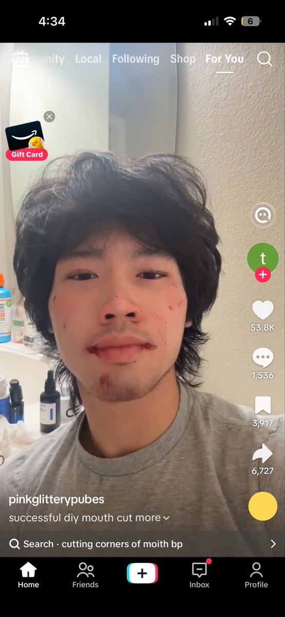 messijusbetter's tweet photo. i hate this fucker sm https://t.co/i01iJIBVhd