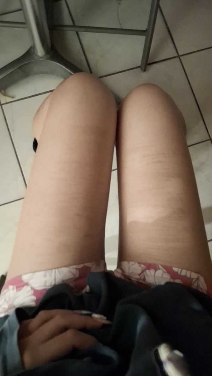 sweetmnffin's tweet photo. bmi 23 thighs #bc #shedtwt https://t.co/wHz5hDzUnF