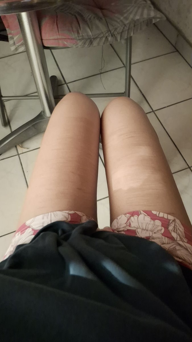 sweetmnffin's tweet photo. bmi 23 thighs #bc #shedtwt https://t.co/wHz5hDzUnF