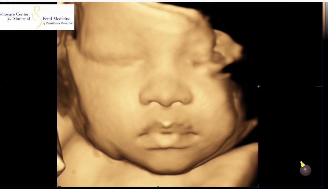 simplymye__'s tweet photo. My girl was serving face in her ultrasounds 😭💕✨ https://t.co/7vKnnoZR7P