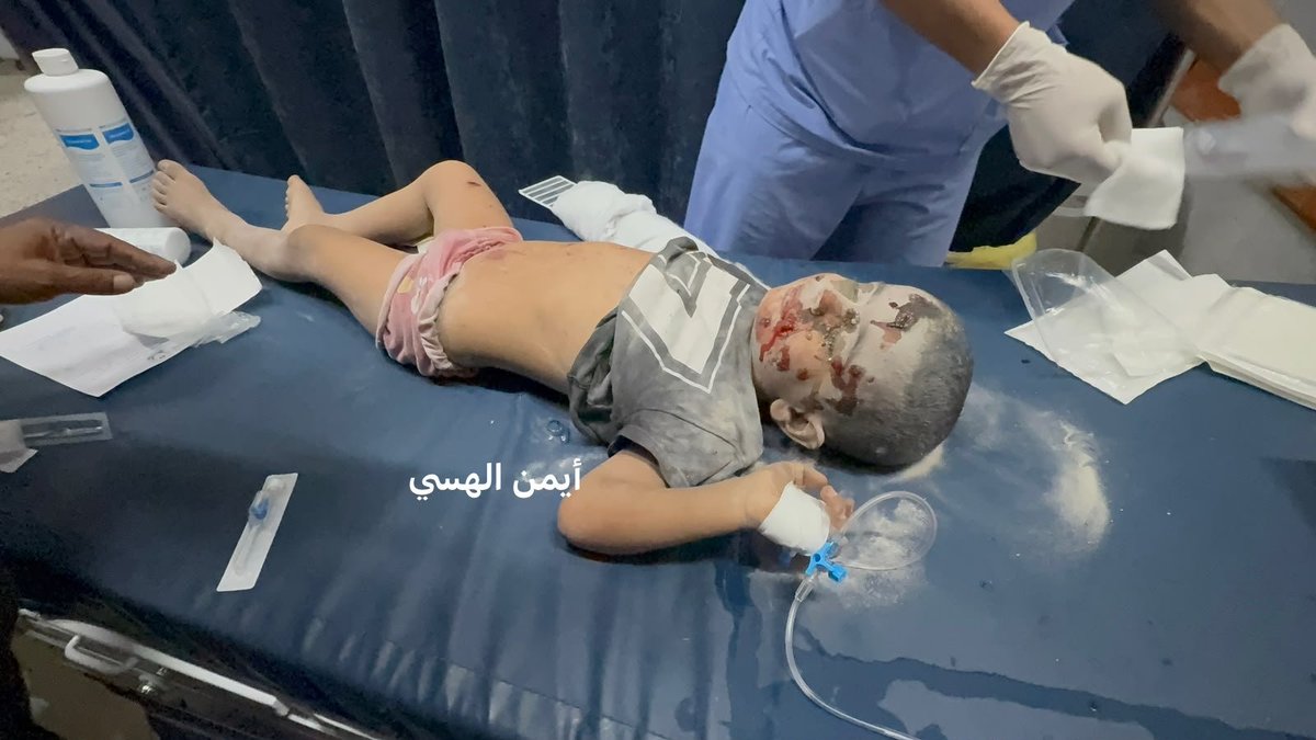 AnasAlSharif0's tweet photo. #عاجل تحديث
عشرة اصابات غالبيتهم من الأطفال وبعضهم في حالة حرجة جراء قصف طائرات الاحتلال شقة سكنية قرب ملعب فلسطين بغزة . https://t.co/UXQh40KRR5