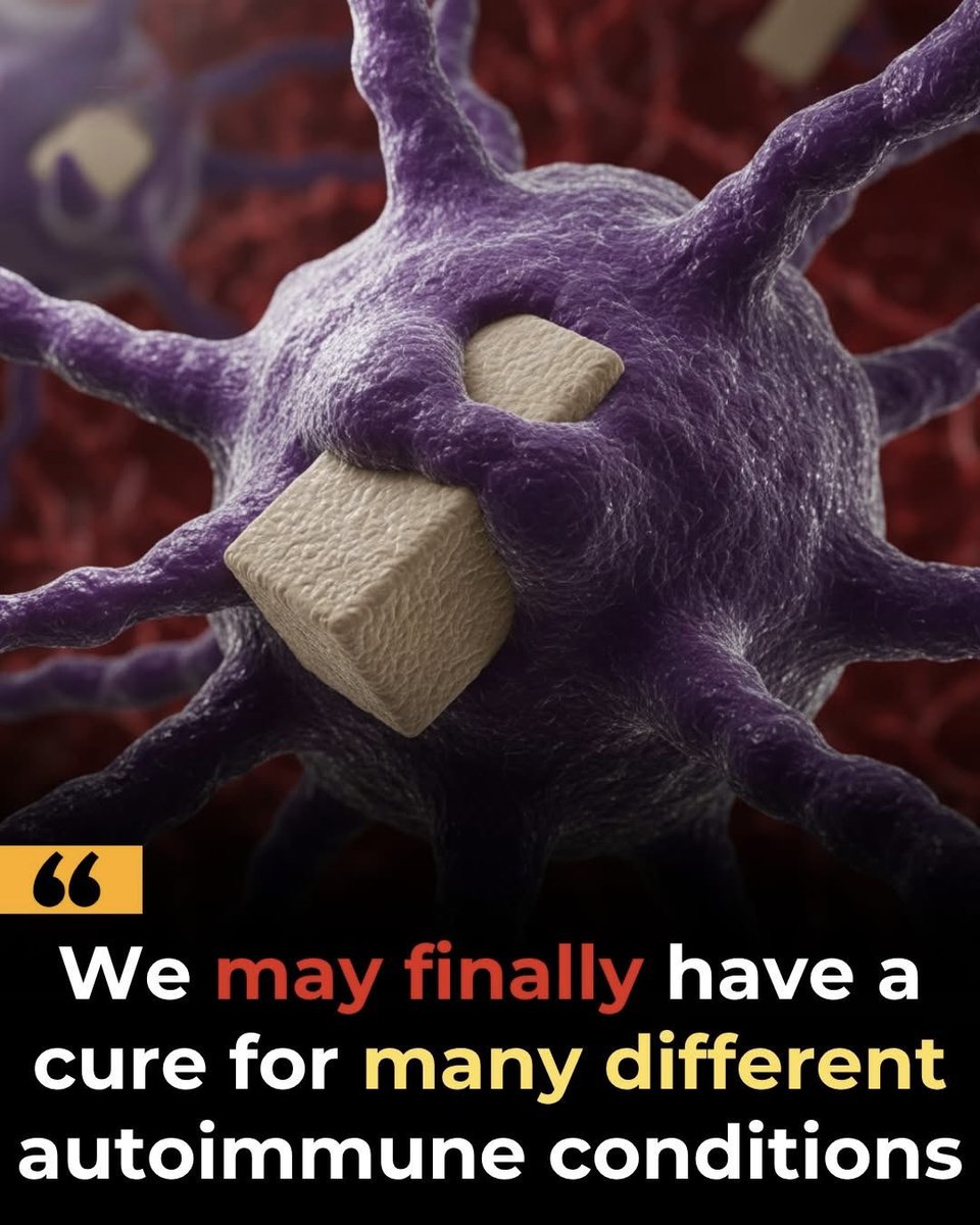 scitechgirl's tweet photo. 🧬 Scientists May Have Found a Way to RESET Autoimmune Diseases

Imagine treating lupus, MS, or type 1 diabetes not with lifelong medicine… but by rebooting the immune system itself.
Scientists are now using genetically engineered immune cells to hunt down the exact cells causing autoimmune disease. In early trials, some patients experienced complete remission — something once thought impossible.

Even more surprising? Many dangerous side effects seen in cancer treatments were missing.
If these trials continue to succeed, this breakthrough could change millions of lives forever.

Source: Mackensen, A., et al. Nature Medicine. “Anti-CD19 CAR T cell therapy for refractory systemic lupus erythematosus.”