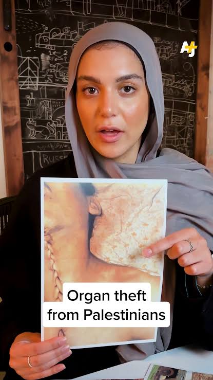 AWMDF2003's tweet photo. @Cockroachthecat @koshercockney “IsraHell has the highest rate of kidney donations on Earth”, you mean all the kidney and organ harvesting theft you sick animals do to Palestinians and Gentiles.

 Is it in your culture to steal everything and claim it as yours? https://t.co/UEwIWbm8kq