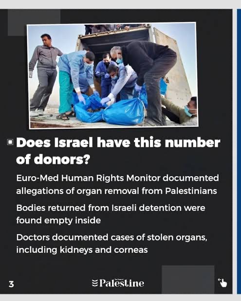 AWMDF2003's tweet photo. @Cockroachthecat @koshercockney “IsraHell has the highest rate of kidney donations on Earth”, you mean all the kidney and organ harvesting theft you sick animals do to Palestinians and Gentiles.

 Is it in your culture to steal everything and claim it as yours? https://t.co/UEwIWbm8kq