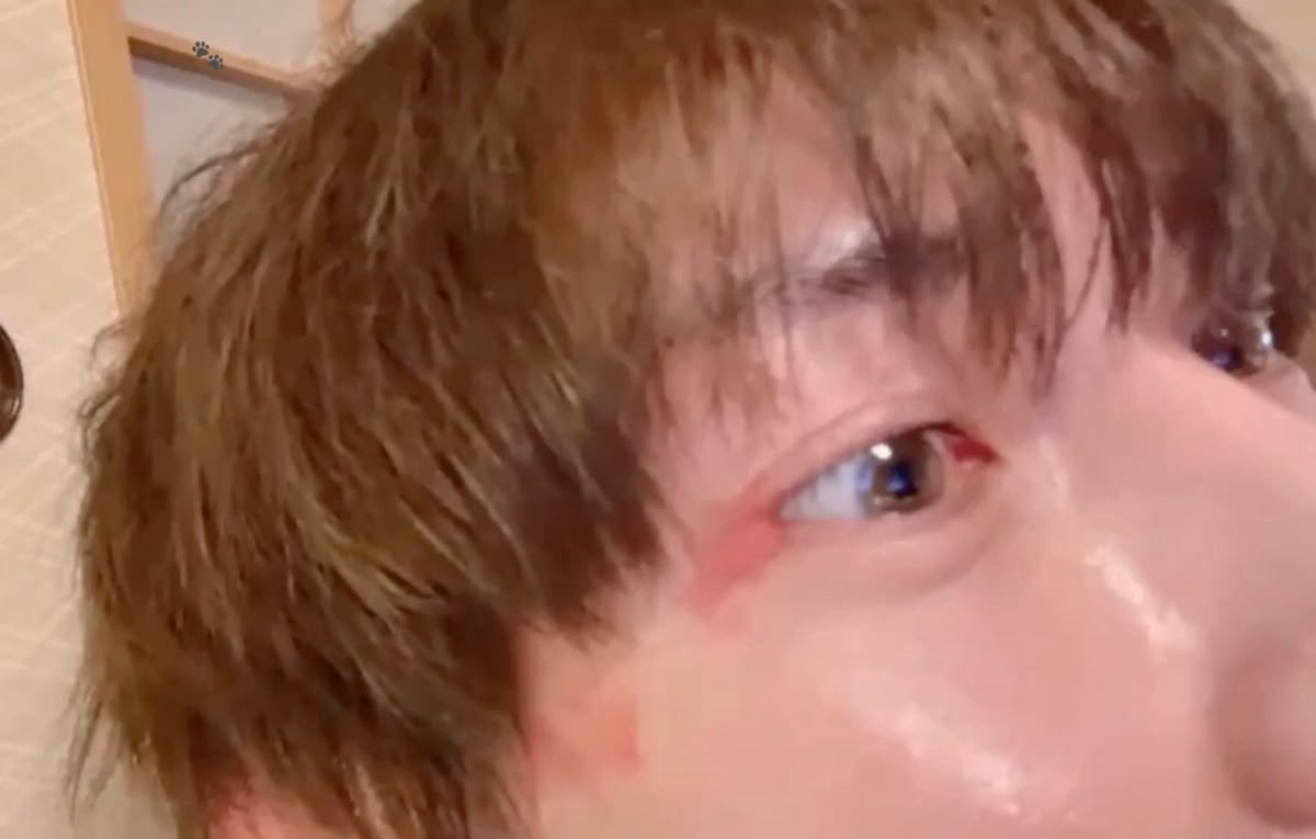puppysang's tweet photo. i love his eyes and birthmark https://t.co/LYpZPBrjxZ