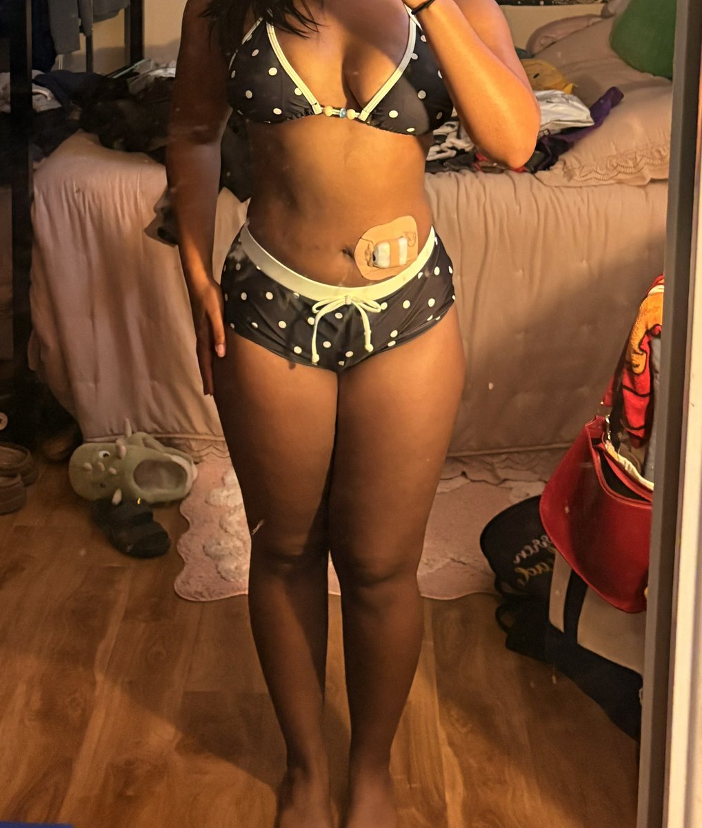 gangsgles's tweet photo. help I recently got diagnosed with t1d and have been feeling like #fatspo how do I lose 20 lbs in 2 weeks https://t.co/cFF07Gv9lD