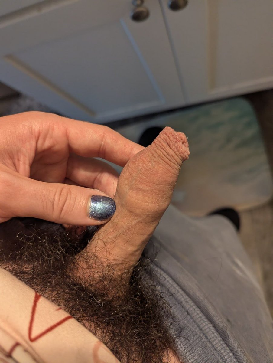 dirtyeen's tweet photo. been stretching my foreskin for the past year- haven't been measuring but that sure looks like progress to me! https://t.co/e0UuDgGtAN