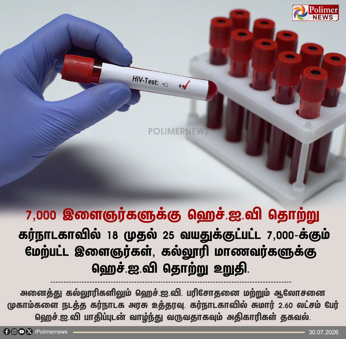 polimernews's tweet photo. #NEWSUPDATE || கர்நாடகாவில் 7,000 இளைஞர்களுக்கு ஹெச்.ஐ.வி தொற்று | #Karnataka | #HIV | #Postive | #Govt | #Students | #PolimerNews https://t.co/pOvqeQCoY6