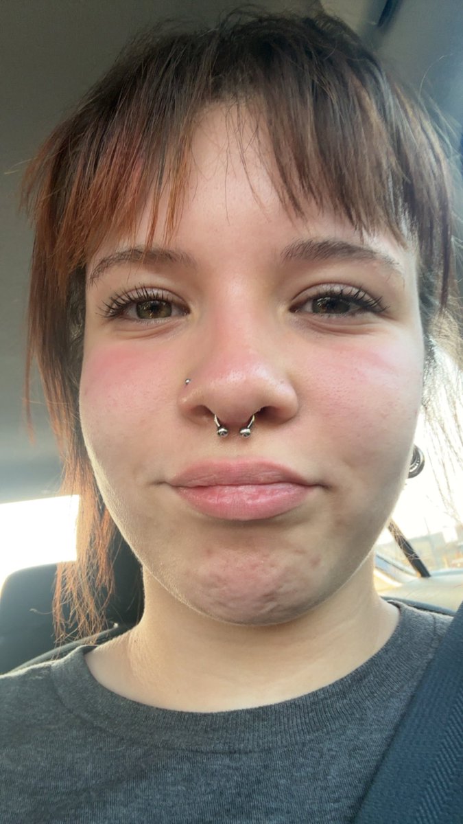 extradehydrated tweet picture