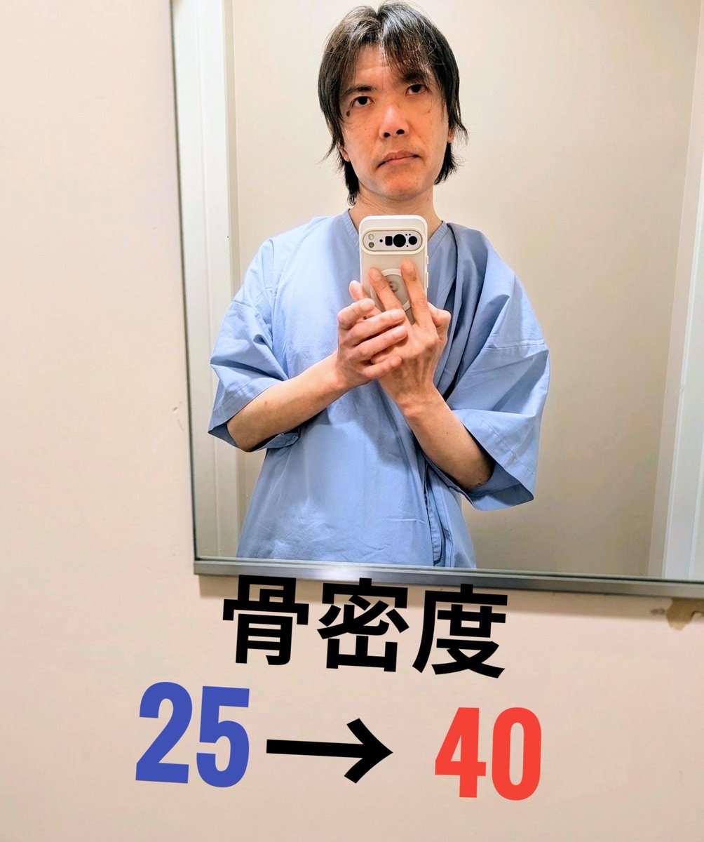 tome0938's tweet photo. 先日 外来 通院の時にした 骨塩定量検査の結果を聞いてきた

今年は 骨粗鬆症の治療をしてるのだけど
ちょうど折り返しの半年ということでの骨塩定量検査

治療を始める前は 骨密度 25だったのが
半年間で 40まで上がった⤴️

半年で 15ということは
また半年後 治療が終わる頃には
55まで上がるはず https://t.co/zko1J32CeI