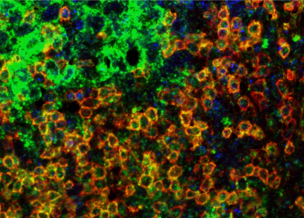An illustration of CAR NK cells.