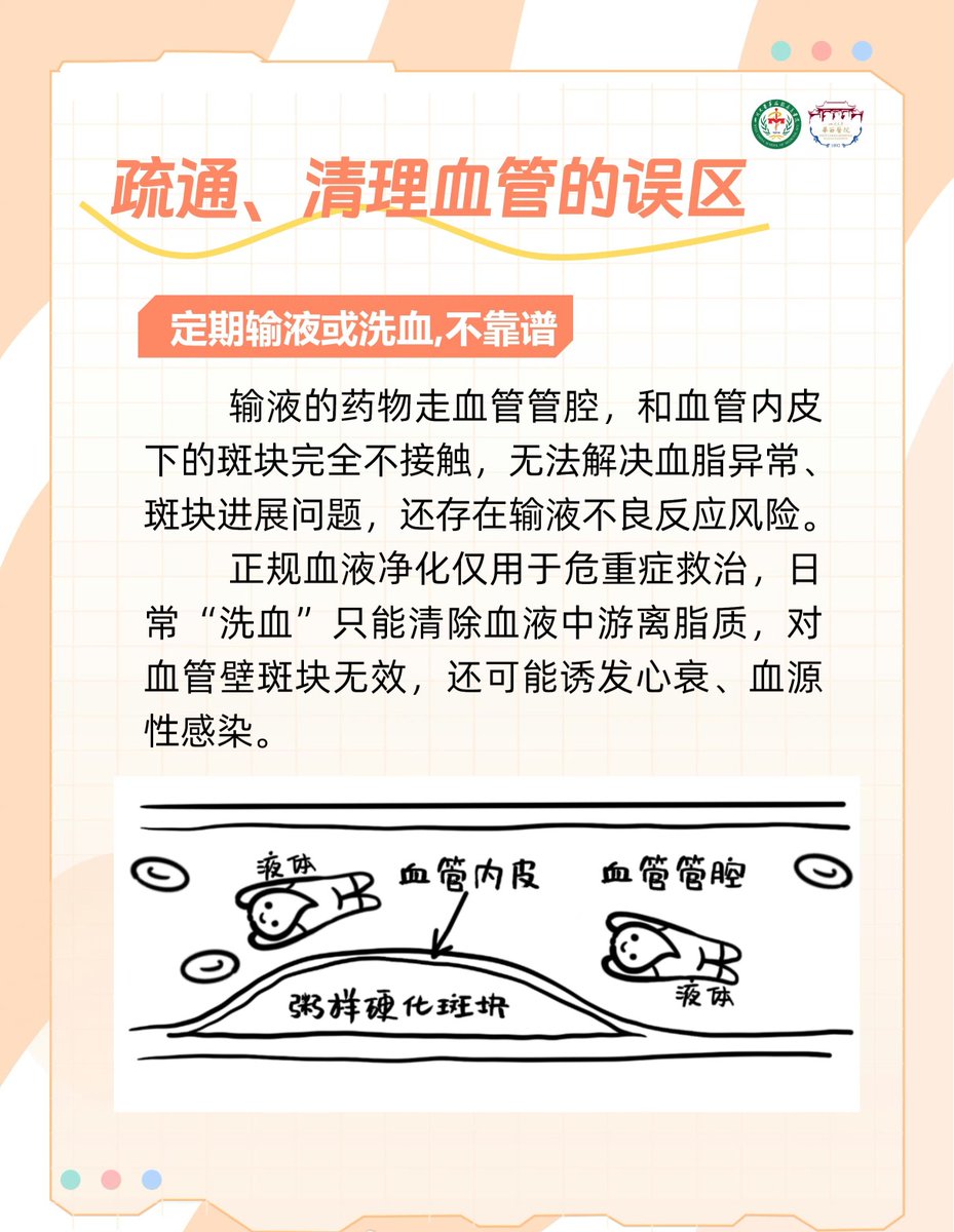 HotmailfromSH's tweet photo. 「医学科普：喝红酒、喝醋能缓解血管堵塞？能养护血管的方法只有这5个」 https://t.co/pC91T0BZJg