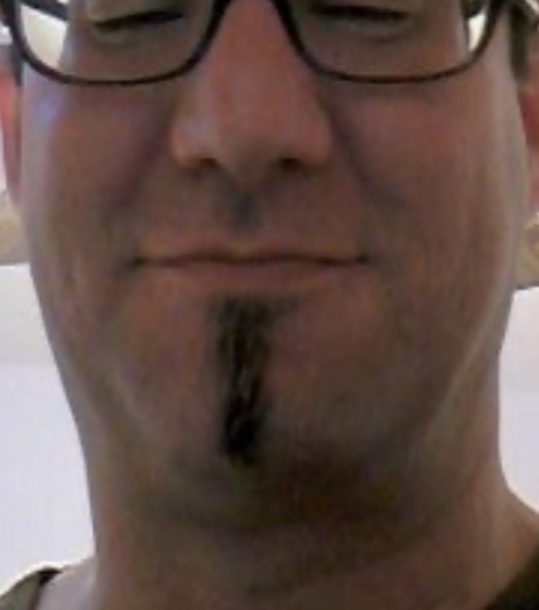 AWMDF2003's tweet photo. @MikeTGlassman @EVKontorovich 15 hours later to come back with that. Figures for a neckless, double chin looking dork with a gross hairy🍆underneath the mouth https://t.co/aeIIcyQJRf