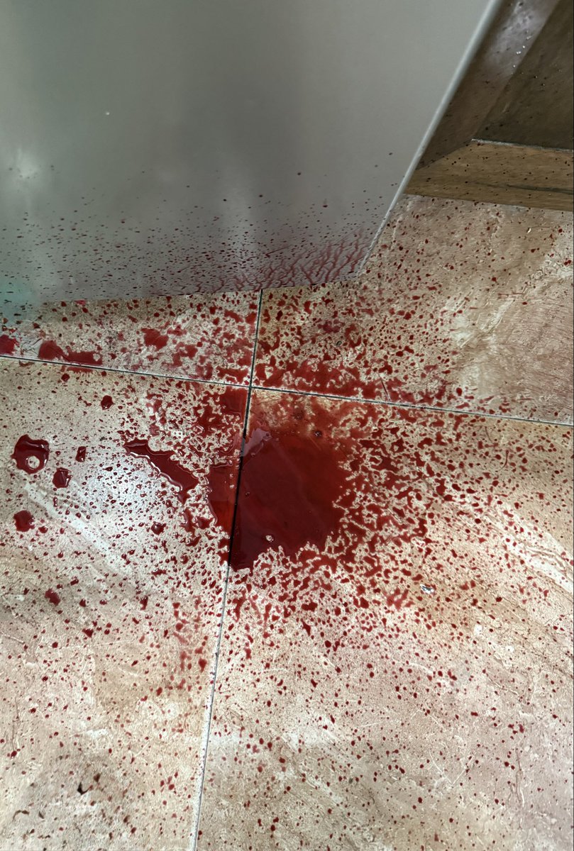 gjs82iwT's tweet photo. beetroot juice spilled on the ground
The shape is really bloody😐 https://t.co/GlavoQrWJz