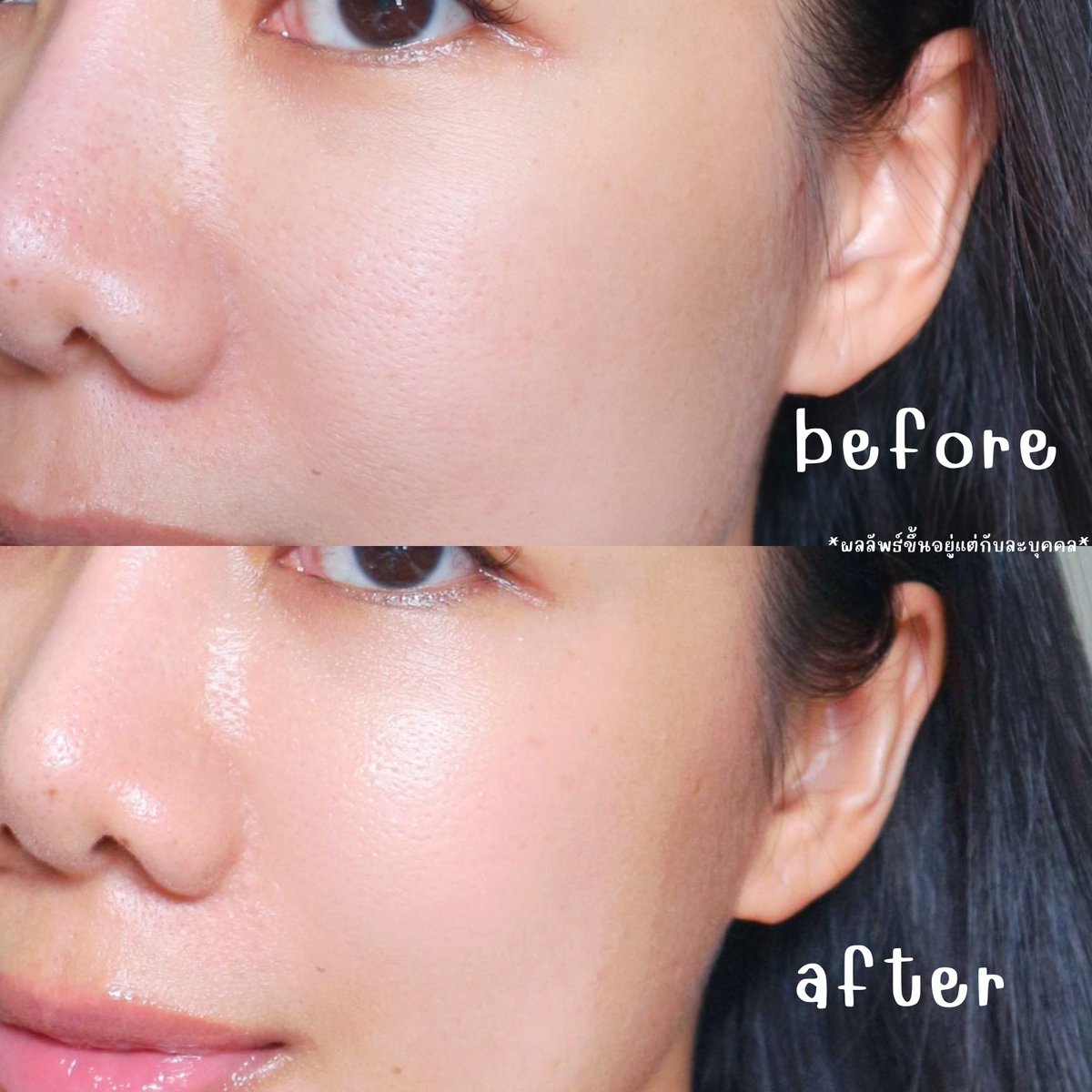 inkmaya's tweet photo. เรานะอิน PDRN มาก ล่าสุด BOJ ออกเซรั่ม PDRN+PEPTIDE ทาแล้วผิวอิ่มแน่นฟู
รูขุมขนดูกระชับ ผิวยืดหยุ่นขึ้น หน้าดูโกลว์สุขภาพดี เต็มสิบไม่หักเลย ทาก่อนลงเมคอัพก็ยิ่งอัพผิวโกลว์สวย https://t.co/CeRRAatE3e
