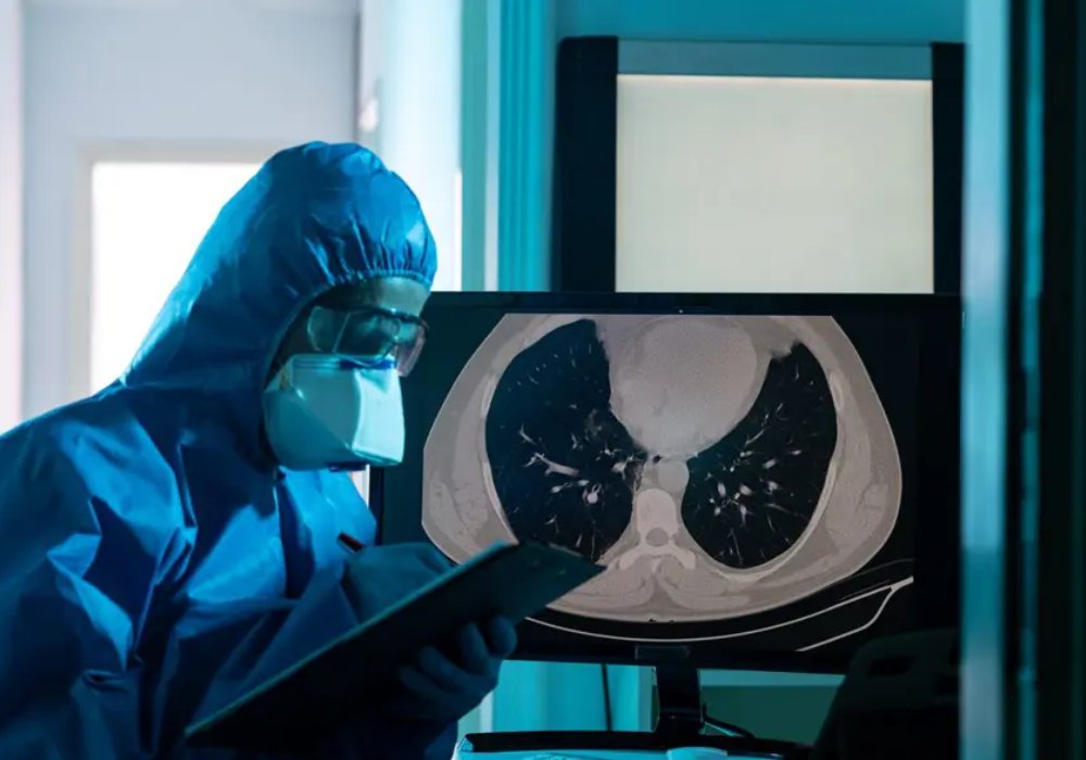 ehealthmgmt's tweet photo. 🚨 Can imaging help detect #Hantavirus earlier? New insights on CT, X-ray & infection control after the Andes virus cruise outbreak. Read more: https://t.co/COeKc7Pa41 #Radiology #EmergencyMedicine #CT #PublicHealth #InfectionControl #AndesVirus https://t.co/suDNuqcfmF