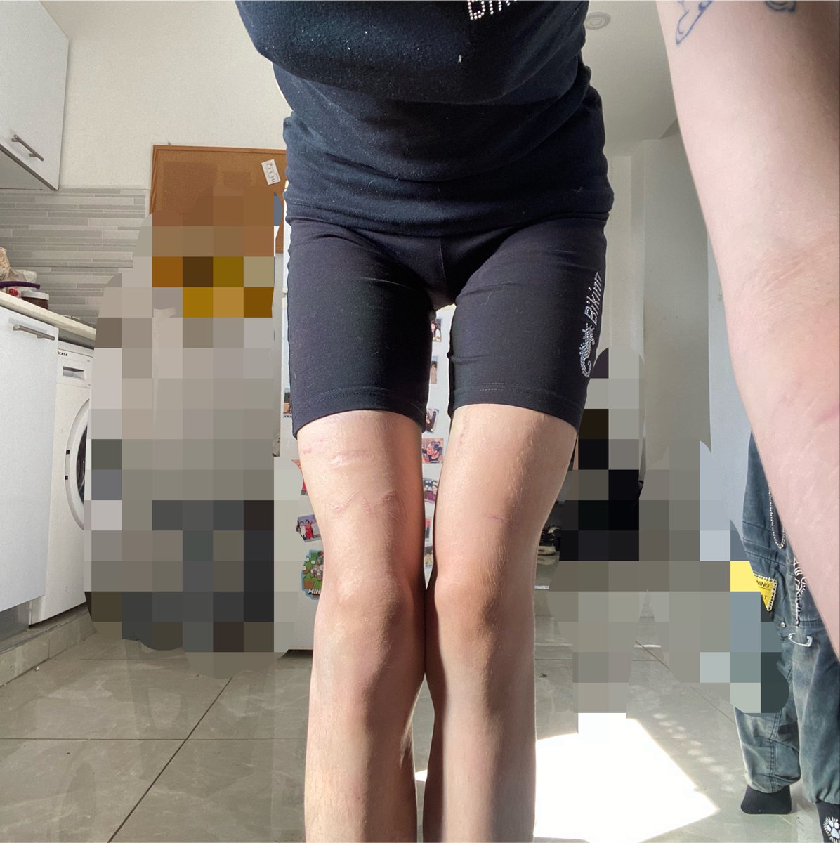 eternalkcals's tweet photo. forced knees together 
i feel like a fake for my leg shape https://t.co/XoFdIyIKCO